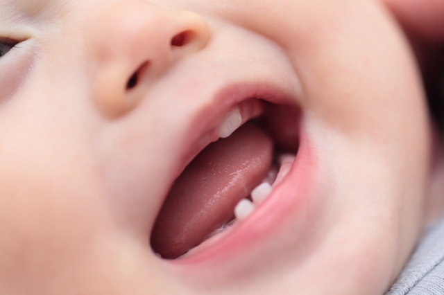 赤ちゃんの歯の写真