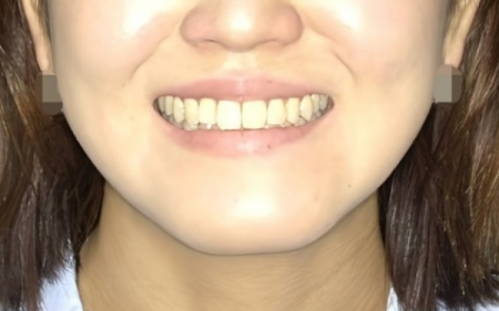 After