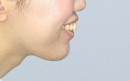 Before