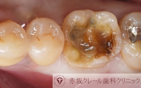 Before