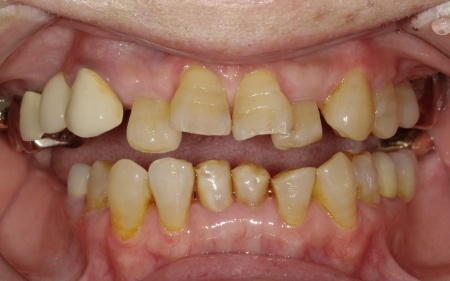 Before