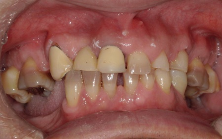 Before