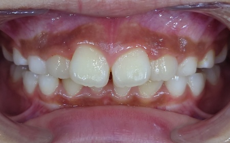 After