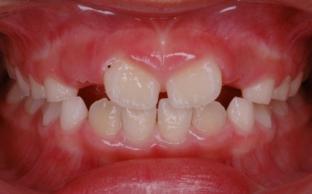 Before