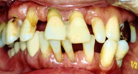 Before