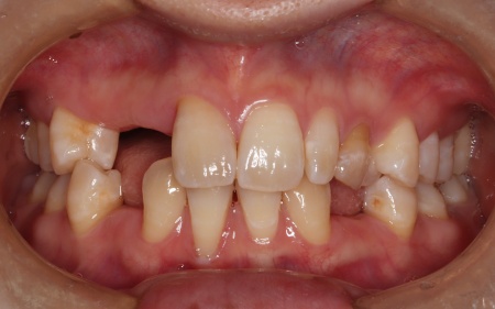 Before