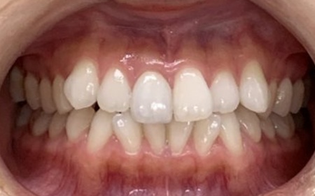 Before