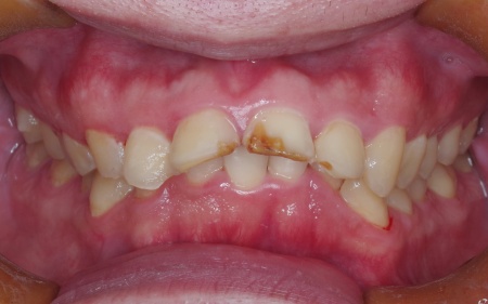 Before