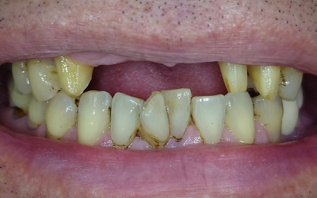 Before