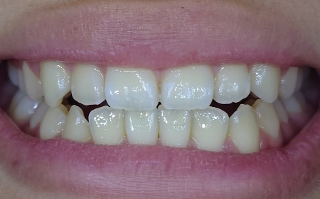 After