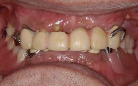 Before