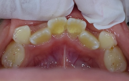 Before