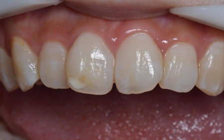 Before