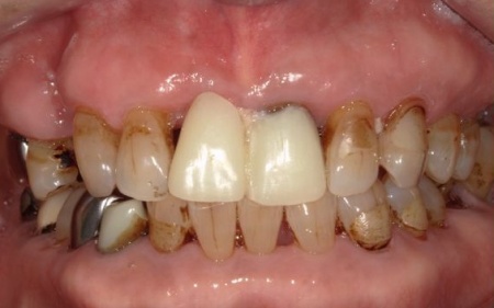 Before