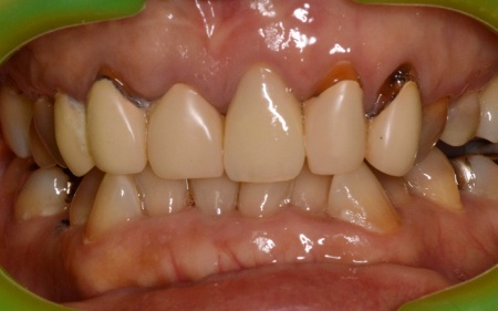 Before