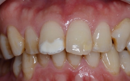 Before