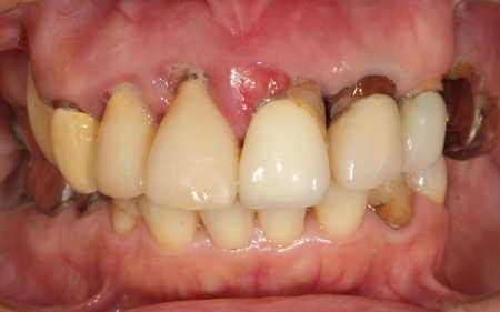 Before