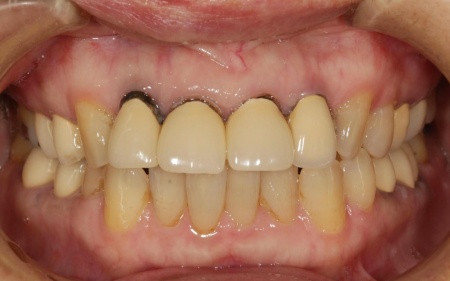Before