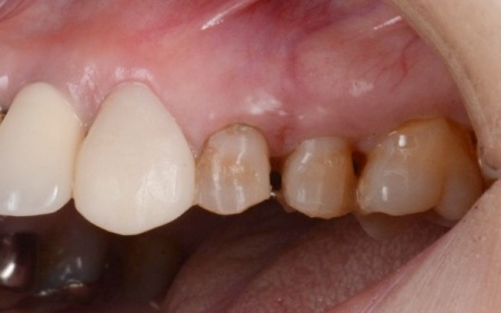 Before