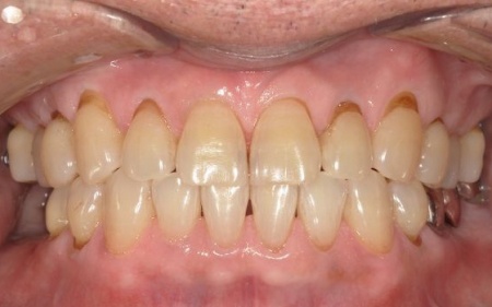 Before
